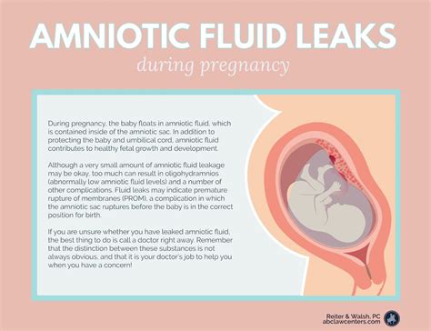 how do you know your leaking amniotic fluid|Leaking Amniotic Fluid: Signs in 1st to 3rd Trimester